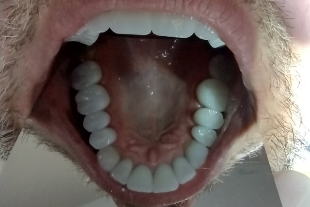 Realizacja 1